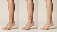 Geen zwelling: mijn complete routine tegen zwellingen die mij altijd helpt